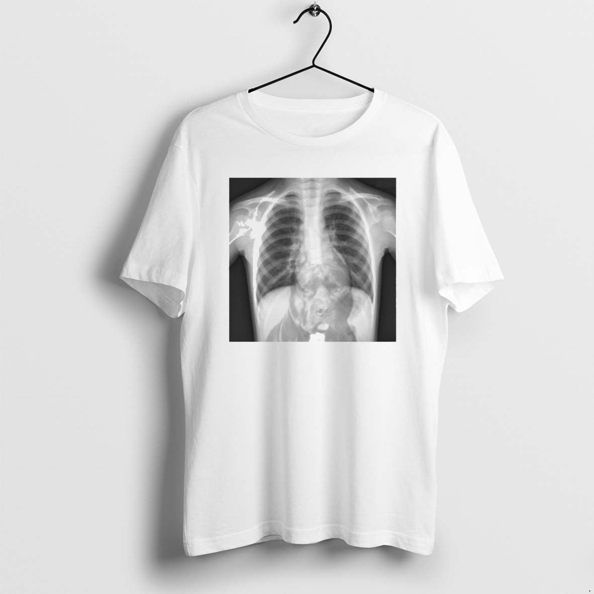 Official Tyler Shoughs Post Game X Ray Confirms Hes Got That Dog In Him